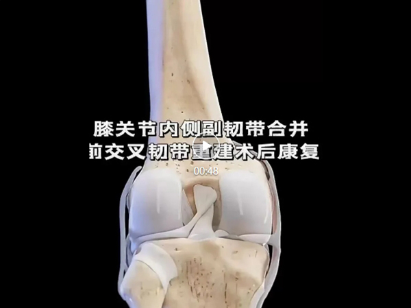 優(yōu)勢技術(shù) | 前交叉韌帶重建 手術(shù)不是終點術(shù)后康復(fù)加快重獲運動能力